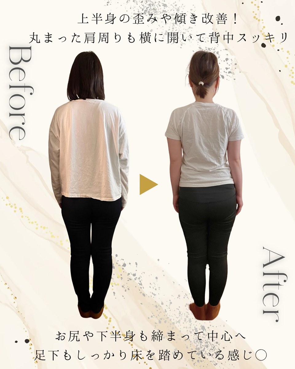 ビフォーアフター
